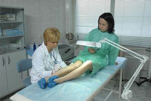 Laserteraapia jalgade veenilaiendite korral